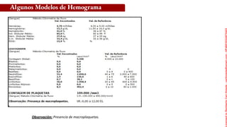 Observación: Presencia de macroplaquetas.
Algunos Modelos de Hemograma
Licensed
to
Remberto
Cari
Hojeda
-
carihojeda@gmail.com
-
HP46816324875423
 
