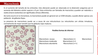 Es el aumento del tamaño de los eritrocitos. Esta alteración puede ser observada en la distensión sanguínea por el
aumento del diámetro celular superior a 9 µm. Estos eritrocitos son llamados de macrocitos y pueden ser redondos u
ovales (macro-ovalocitos) con significados clínicos diferentes.
Así como ocurre en la microcitosis, la macrocitosis puede ser general con un VCM elevado, o puede afectar apenas una
población de glóbulos Rojos.
La presencia de macrocitosis puede ser a causa de una reticulocitosis Los reticulocitos son células inmaduras,
normalmente de mayor tamaño que los glóbulos rojos maduros.
Macrocitosis
Macrocitosis escasa Macrocitosis (+) Macrocitosis
Macrocitosis moderada Macrocitosis (++)
Macrocitosis abundante Macrocitosis (+++)
Posibles formas de informar
Licensed
to
Remberto
Cari
Hojeda
-
carihojeda@gmail.com
-
HP46816324875423
 