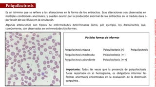 Posibles formas de informar
Es un término que se refiere a las alteraciones en la forma de los eritrocitos. Esas alteraciones son observadas en
múltiples condiciones anormales, y pueden ocurrir por la producción anormal de los eritrocitos en la médula ósea o
por lesión de las células en la circulación.
Algunas alteraciones son típicas de enfermedades determinadas como, por ejemplo, los drepanocitos que,
comúnmente, son observados en enfermedades falciformes.
Importante: Todas las veces que la presencia de poiquilocitosis
fuese reportada en el hemograma, es obligatorio informar las
formas anormales encontradas en la evaluación de la distensión
sanguínea .
Poiquilocitosis
Poiquilocitosis escasa Poiquilocitosis (+) Poiquilocitosis
Poiquilocitosis moderada Poiquilocitosis (++)
Poiquilocitosis abundante Poiquilocitosis (+++)
Licensed
to
Remberto
Cari
Hojeda
-
carihojeda@gmail.com
-
HP46816324875423
 