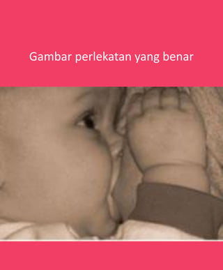 Gambar perlekatan yang benar
 