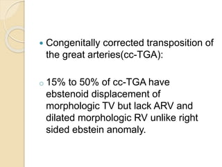  Congenitally corrected transposition of
the great arteries(cc-TGA):
o 15% to 50% of cc-TGA have
ebstenoid displacement of
morphologic TV but lack ARV and
dilated morphologic RV unlike right
sided ebstein anomaly.
 