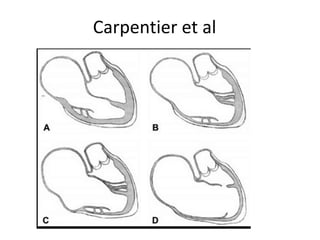 Carpentier et al
 