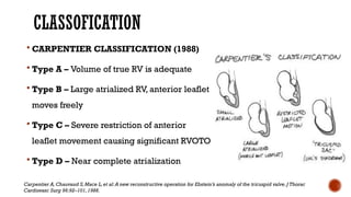 CLASSOFICATION
 CARPENTIER CLASSIFICATION (1988)
 Type A – Volume of true RV is adequate
 Type B – Large atrialized RV, anterior leaflet
moves freely
 Type C – Severe restriction of anterior
leaflet movement causing significant RVOTO
 Type D – Near complete atrialization
Carpentier A,Chauvaud S,Mace L,et al:A new reconstructive operation for Ebstein’s anomaly of the tricuspid valve.J Thorac
Cardiovasc Surg 96:92–101,1988.
 