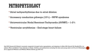 PATHOPHYSIOLOGY
 Atrial tachyarrhythmias due to atrial dilation
 Accessory conduction pthways (15%) – WPW syndrome
 Atrioventricular Nodal Reentrant Tachycardia (AVNRT) – 1-2%
 Ventricular arryhthmias – End stage heart failure
Said SM,Dearani JA: Ebstein’s anomaly,congenital tricuspid valve regurgitation,and dysplasia.In Allen HD, Driscoll DJ,Shaddy RE,et al,
editors: Moss and Adams’ heart disease in infants,children,and adolescents including the fetus and young adult,vol 39,ed 8,Philadelphia,
2013,LippincottWilliams andWilkins,Wolters Kluwer,pp 889–912.
 