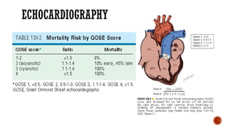 ECHOCARDIOGRAPHY
 
