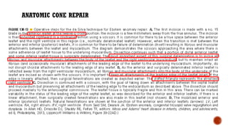 ANATOMIC CONE REPAIR
 
