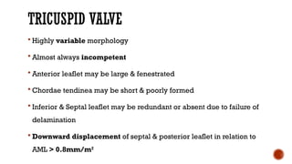 TRICUSPID VALVE
 Highly variable morphology
 Almost always incompetent
 Anterior leaflet may be large & fenestrated
 Chordae tendinea may be short & poorly formed
 Inferior & Septal leaflet may be redundant or absent due to failure of
delamination
 Downward displacement of septal & posterior leaflet in relation to
AML > 0.8mm/m2
 