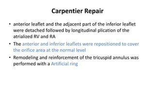 Carpentier Repair
• anterior leaflet and the adjacent part of the inferior leaflet
were detached followed by longitudinal plication of the
atrialized RV and RA
• The anterior and inferior leaflets were repositioned to cover
the orifice area at the normal level
• Remodeling and reinforcement of the tricuspid annulus was
performed with a Artificial ring
 
