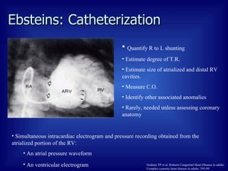 Ebsteins: Catheterization Quantify R to L shunting Estimate degree of T.R.  Estimate size of atrialized and distal RV cavities. Measure C.O. Identify other associated anomalies Rarely, needed unless assessing coronary anatomy Simultaneous intracardiac electrogram and pressure recording obtained from the atrialized portion of the RV: An atrial pressure waveform An ventricular electrogram   Graham TP et al. Roberts Congenital Heart Disease in adults.  Complex cyanotic heart disease in adults: 395-99. 