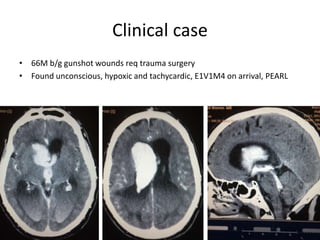 Clinical case
• 66M b/g gunshot wounds req trauma surgery
• Found unconscious, hypoxic and tachycardic, E1V1M4 on arrival, PEARL
 