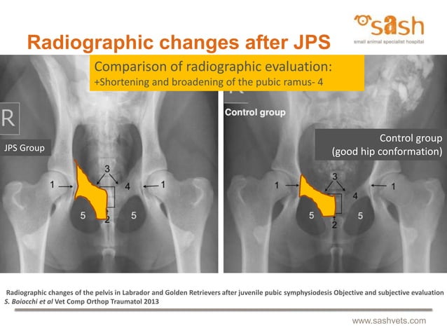 SASH : Juvenile pubic symphysiodesis by Dr Daniel R James | PPT