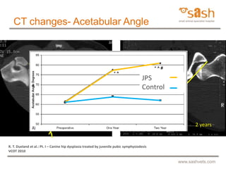 SASH : Juvenile pubic symphysiodesis by Dr Daniel R James | PPTX