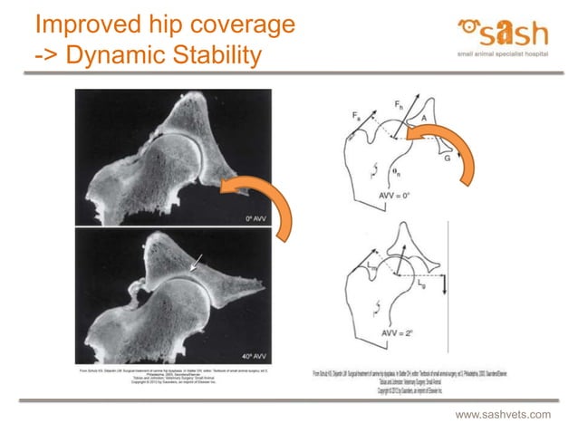 SASH : Juvenile pubic symphysiodesis by Dr Daniel R James | PPT