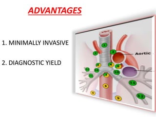 ADVANTAGES
1. MINIMALLY INVASIVE
2. DIAGNOSTIC YIELD
 