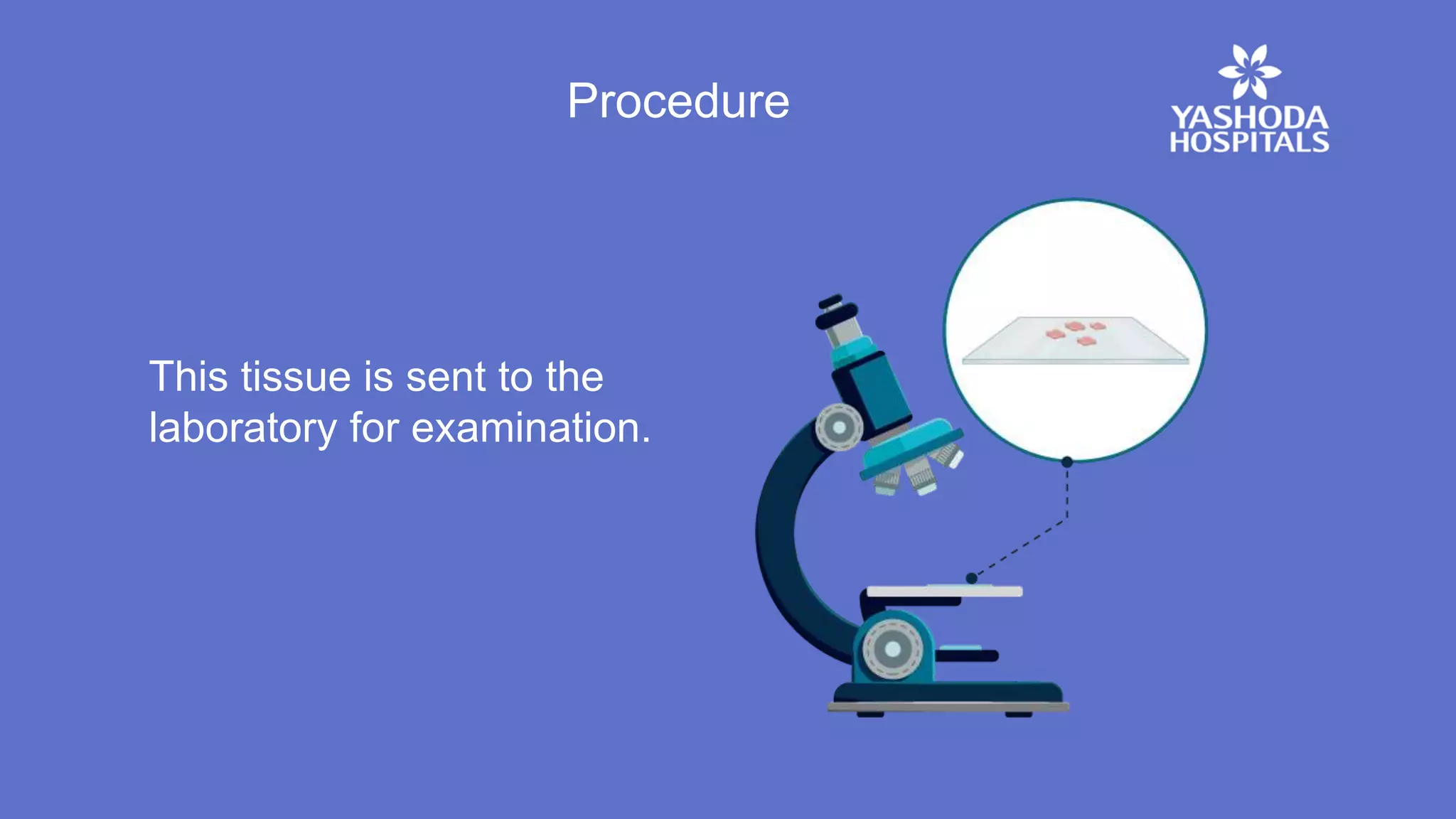 Procedure
This tissue is sent to the
laboratory for examination.