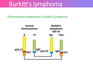 Burkitt's lymphoma
 