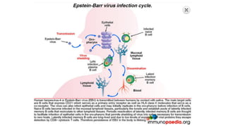 EBV notes | PDF