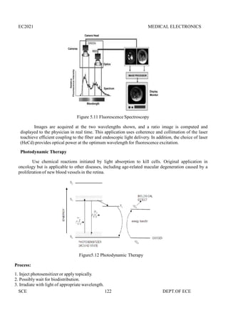 EC2021 MEDICAL ELECTRONICS
SCE 122 DEPT.OF ECE
Figure 5.11 Fluorescence Spectroscopy
Images are acquired at the two wavelengths shown, and a ratio image is computed and
displayed to the physician in real time. This application uses coherence and collimation of the laser
toachieve efficient coupling to the fiber and endoscopic light delivery. In addition, the choice of laser
(HeCd) provides optical power at the optimum wavelength for fluorescence excitation.
Photodynamic Therapy
Use chemical reactions initiated by light absorption to kill cells. Original application in
oncology but is applicable to other diseases, including age-related macular degeneration caused by a
proliferation of new blood vessels in the retina.
Figure5.12 Photodynamic Therapy
Process:
1. Inject photosensitizer or apply topically.
2. Possibly wait for biodistribution.
3. Irradiate with light of appropriate wavelength.
EC2021 MEDICAL ELECTRONICS
SCE 122 DEPT.OF ECE
Figure 5.11 Fluorescence Spectroscopy
Images are acquired at the two wavelengths shown, and a ratio image is computed and
displayed to the physician in real time. This application uses coherence and collimation of the laser
toachieve efficient coupling to the fiber and endoscopic light delivery. In addition, the choice of laser
(HeCd) provides optical power at the optimum wavelength for fluorescence excitation.
Photodynamic Therapy
Use chemical reactions initiated by light absorption to kill cells. Original application in
oncology but is applicable to other diseases, including age-related macular degeneration caused by a
proliferation of new blood vessels in the retina.
Figure5.12 Photodynamic Therapy
Process:
1. Inject photosensitizer or apply topically.
2. Possibly wait for biodistribution.
3. Irradiate with light of appropriate wavelength.
EC2021 MEDICAL ELECTRONICS
SCE 122 DEPT.OF ECE
Figure 5.11 Fluorescence Spectroscopy
Images are acquired at the two wavelengths shown, and a ratio image is computed and
displayed to the physician in real time. This application uses coherence and collimation of the laser
toachieve efficient coupling to the fiber and endoscopic light delivery. In addition, the choice of laser
(HeCd) provides optical power at the optimum wavelength for fluorescence excitation.
Photodynamic Therapy
Use chemical reactions initiated by light absorption to kill cells. Original application in
oncology but is applicable to other diseases, including age-related macular degeneration caused by a
proliferation of new blood vessels in the retina.
Figure5.12 Photodynamic Therapy
Process:
1. Inject photosensitizer or apply topically.
2. Possibly wait for biodistribution.
3. Irradiate with light of appropriate wavelength.
 