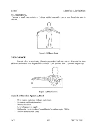 EC2021 MEDICAL ELECTRONICS
SCE 132 DEPT.OF ECE
MACRO-SHOCK:
External or touch - current shock (voltage applied externally, current pass through the skin in
and out
Figure 5.24 Macro shock
MICRO-SHOCK
Current affect heart directly (through pacemaker leads or catheter) Currents less than
(100) micro-Ampere have the potential to cause VF (it is possible from (25) micro-Ampere up).
Figure 5.25Micro shock
Methods of Protection Against El. Shock
 Over-current protection (indirect protection).
 Protective earthing (grounding).
 Double insulation.
 Low voltage power supply.
 Differential circuit breaker (Ground Fault Circuit Interrupter GFCI) .
 Isolated power system (IPS).
 