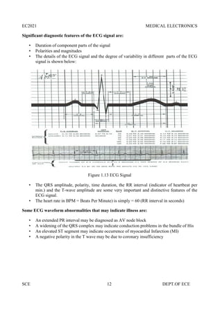 EC2021 MEDICAL ELECTRONICS
SCE 12 DEPT.OF ECE
Significant diagnostic features of the ECG signal are:
 Duration of component parts of the signal
 Polarities and magnitudes
 The details of the ECG signal and the degree of variability in different parts of the ECG
signal is shown below:
Figure 1.13 ECG Signal
 The QRS amplitude, polarity, time duration, the RR interval (indicator of heartbeat per
min.) and the T-wave amplitude are some very important and distinctive features of the
ECG signal.
 The heart rate in BPM = Beats Per Minute) is simply = 60 (RR interval in seconds)
Some ECG waveform abnormalities that may indicate illness are:
 An extended PR interval may be diagnosed as AV node block
 A widening of the QRS complex may indicate conduction problems in the bundle of His
 An elevated ST segment may indicate occurrence of myocardial Infarction (MI)
 A negative polarity in the T wave may be due to coronary insufficiency
 