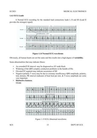 EC2021 MEDICAL ELECTRONICS
SCE 13 DEPT.OF ECE
1.4.1 ECG Leads
A Normal ECG recording for the standard lead connections leads I, II and III (Lead II
provides the strongest signal)
Figure 1.14 Normal ECG waveforms
Obviously, all human hearts are not the same and this results into a high degree of variability.
Some abnormalities that may indicate illness:
 An extended P-R interval may be diagnosed as AV node block
 Widening of the QRS complex conduction problems in the bundle of His
 Elevated ST segment may indicate occurrence of MI
 Negative polarity T wave may be due to coronary insufficiency QRS amplitude, polarity,
time domain, PR interval (indicator of heat beat per min. & T-wave amplitude are some
very important.
 Distinctive features.
1.Loss
Figure 1.15 ECG Abnormal waveforms
 