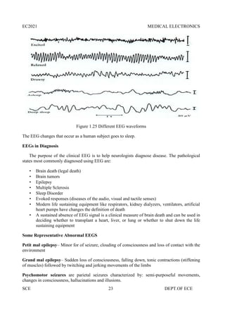 EC2021 MEDICAL ELECTRONICS
SCE 23 DEPT.OF ECE
Figure 1.25 Different EEG waveforms
The EEG changes that occur as a human subject goes to sleep.
EEGs in Diagnosis
The purpose of the clinical EEG is to help neurologists diagnose disease. The pathological
states most commonly diagnosed using EEG are:
 Brain death (legal death)
 Brain tumors
 Epilepsy
 Multiple Sclerosis
 Sleep Disorder
 Evoked responses (diseases of the audio, visual and tactile senses)
 Modern life sustaining equipment like respirators, kidney dialyzers, ventilators, artificial
heart pumps have changes the definition of death
 A sustained absence of EEG signal is a clinical measure of brain death and can be used in
deciding whether to transplant a heart, liver, or lung or whether to shut down the life
sustaining equipment
Some Representative Abnormal EEGS
Petit mal epilepsy– Minor for of seizure, clouding of consciousness and loss of contact with the
environment
Grand mal epilepsy– Sudden loss of consciousness, falling down, tonic contractions (stiffening
of muscles) followed by twitching and jerking movements of the limbs
Psychomotor seizures are parietal seizures characterized by: semi-purposeful movements,
changes in consciousness, hallucinations and illusions.
 