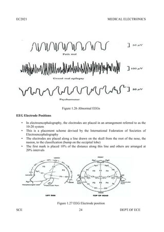 EC2021 MEDICAL ELECTRONICS
SCE 24 DEPT.OF ECE
Figure 1.26 Abnormal EEGs
EEG Electrode Positions
 In electroencephalography, the electrodes are placed in an arrangement referred to as the
10-20 system
 This is a placement scheme devised by the International Federation of Societies of
Electroencephalography
 The electrodes are placed along a line drawn on the skull from the root of the nose, the
nasion, to the classification (bump on the occipital lobe)
 The first mark is placed 10% of the distance along this line and others are arranged at
20% intervals
Figure 1.27 EEG Electrode position
 