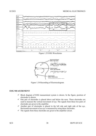 EC2021 MEDICAL ELECTRONICS
SCE 30 DEPT.OF ECE
Figure 1.33 EOG Waveforms
Figure 1.34 Recording of Electroculogram
EOG MEASUREMENT
 Block diagram of EOG measurement system is shown. In the figure, position of
electrodes is shown.
 One pair of electrodes is placed above and below the nose. These electrodes are
used to measure the vertical movement of eye. The signals from these two pairs of
electrodes are given to the amplifier.
 Another pair of electrodes is placed in the left side and right side of the eye.
Horizontal movement of an eye is measured by using these electrodes.
 The signals from these electrodes are given to the amplifier circuit.
EC2021 MEDICAL ELECTRONICS
SCE 30 DEPT.OF ECE
Figure 1.33 EOG Waveforms
Figure 1.34 Recording of Electroculogram
EOG MEASUREMENT
 Block diagram of EOG measurement system is shown. In the figure, position of
electrodes is shown.
 One pair of electrodes is placed above and below the nose. These electrodes are
used to measure the vertical movement of eye. The signals from these two pairs of
electrodes are given to the amplifier.
 Another pair of electrodes is placed in the left side and right side of the eye.
Horizontal movement of an eye is measured by using these electrodes.
 The signals from these electrodes are given to the amplifier circuit.
EC2021 MEDICAL ELECTRONICS
SCE 30 DEPT.OF ECE
Figure 1.33 EOG Waveforms
Figure 1.34 Recording of Electroculogram
EOG MEASUREMENT
 Block diagram of EOG measurement system is shown. In the figure, position of
electrodes is shown.
 One pair of electrodes is placed above and below the nose. These electrodes are
used to measure the vertical movement of eye. The signals from these two pairs of
electrodes are given to the amplifier.
 Another pair of electrodes is placed in the left side and right side of the eye.
Horizontal movement of an eye is measured by using these electrodes.
 The signals from these electrodes are given to the amplifier circuit.
 