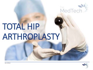 _________________________________________________________________________
Hans Hellinckx
TOTAL HIP
ARTHROPLASTY
 