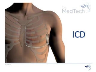 _________________________________________________________________________
Hans Hellinckx
ICD
 