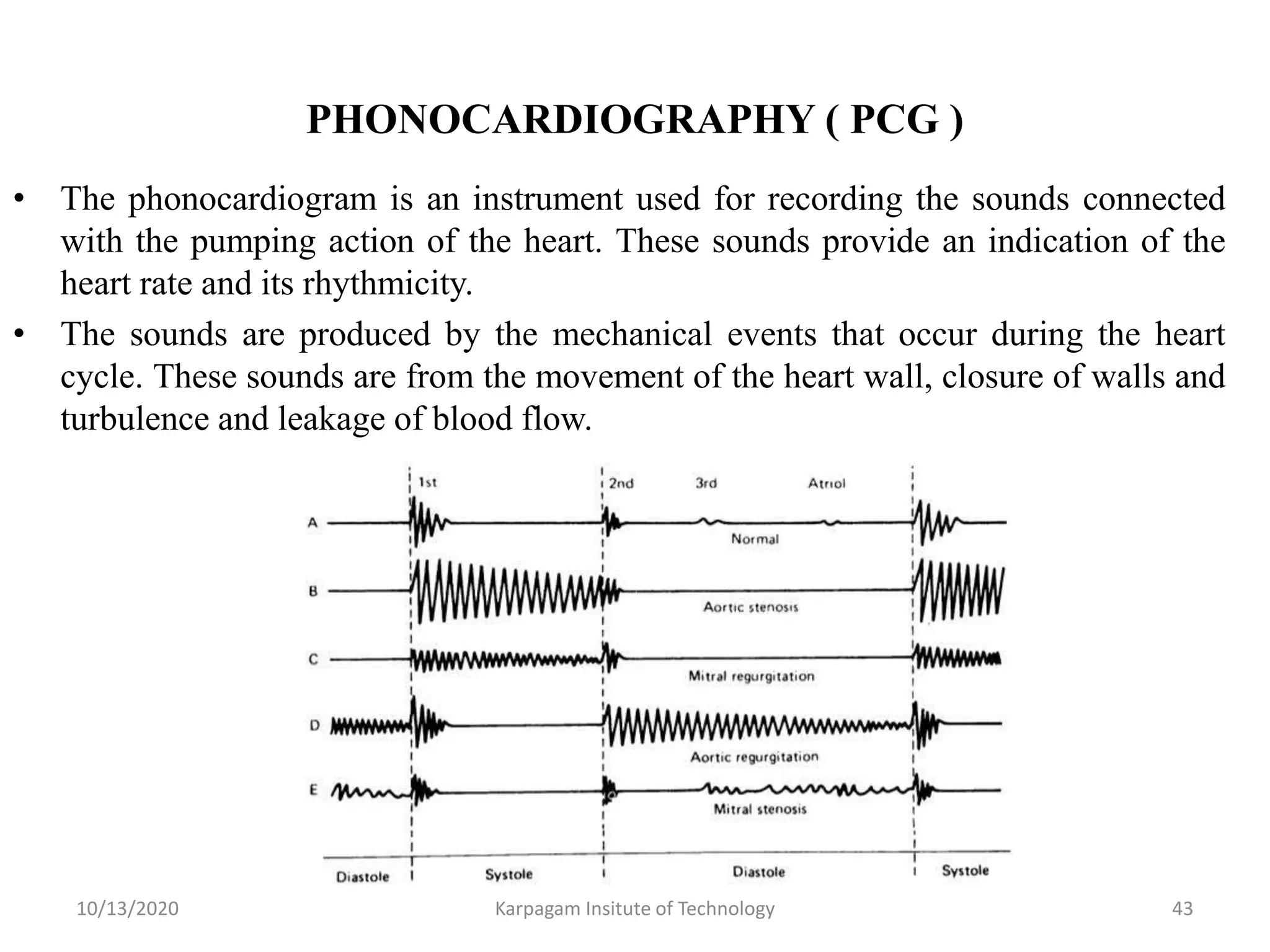PHONOCARDIOGRAPHY ( PCG )
• The phonocardiogram is an instrument used for recording the sounds connected
with the pumping action of the heart. These sounds provide an indication of the
heart rate and its rhythmicity.
• The sounds are produced by the mechanical events that occur during the heart
cycle. These sounds are from the movement of the heart wall, closure of walls and
turbulence and leakage of blood flow.
10/13/2020 Karpagam Insitute of Technology 43
 