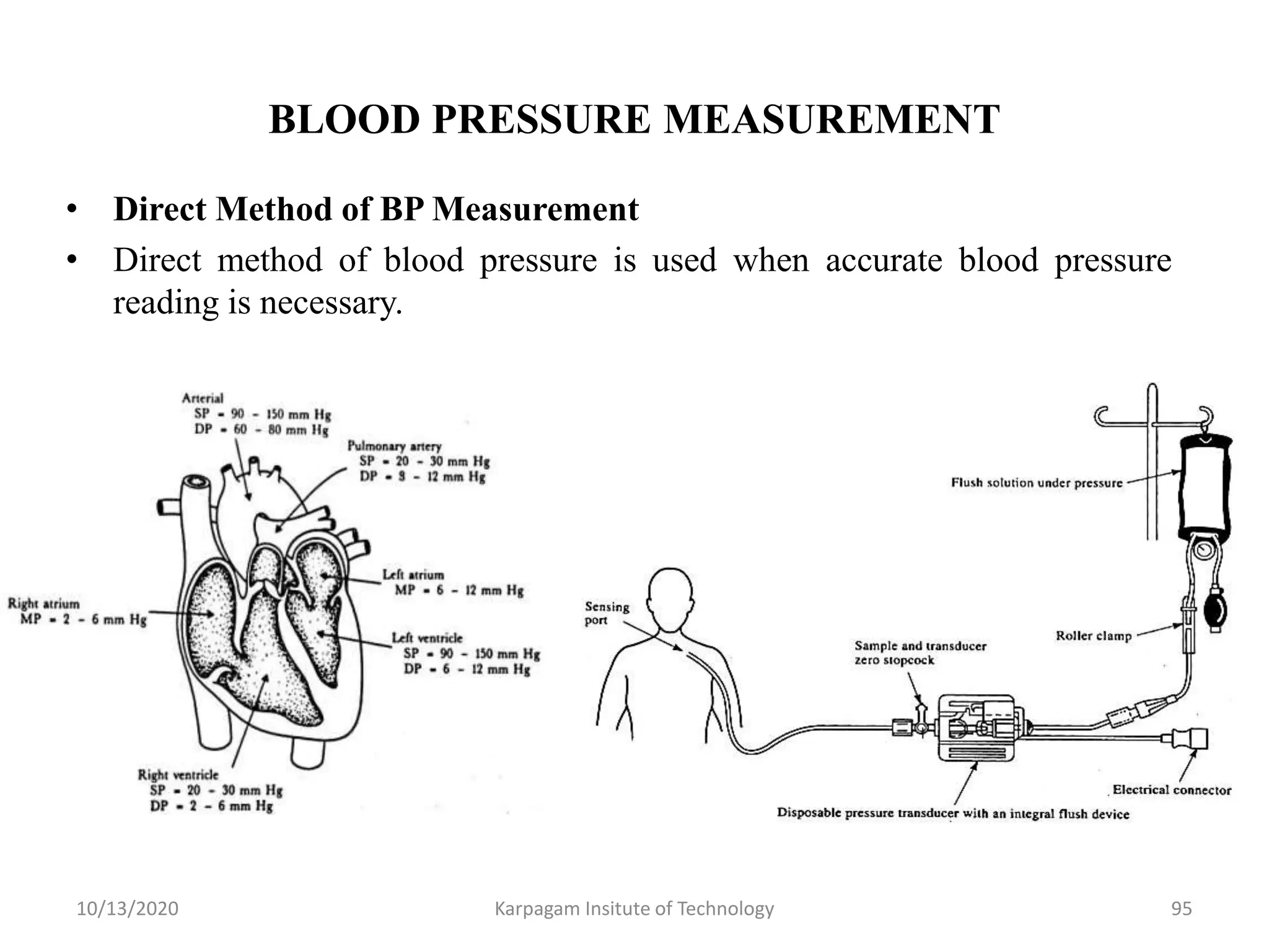 BLOOD PRESSURE MEASUREMENT
• Direct Method of BP Measurement
• Direct method of blood pressure is used when accurate blood pressure
reading is necessary.
10/13/2020 Karpagam Insitute of Technology 95
 