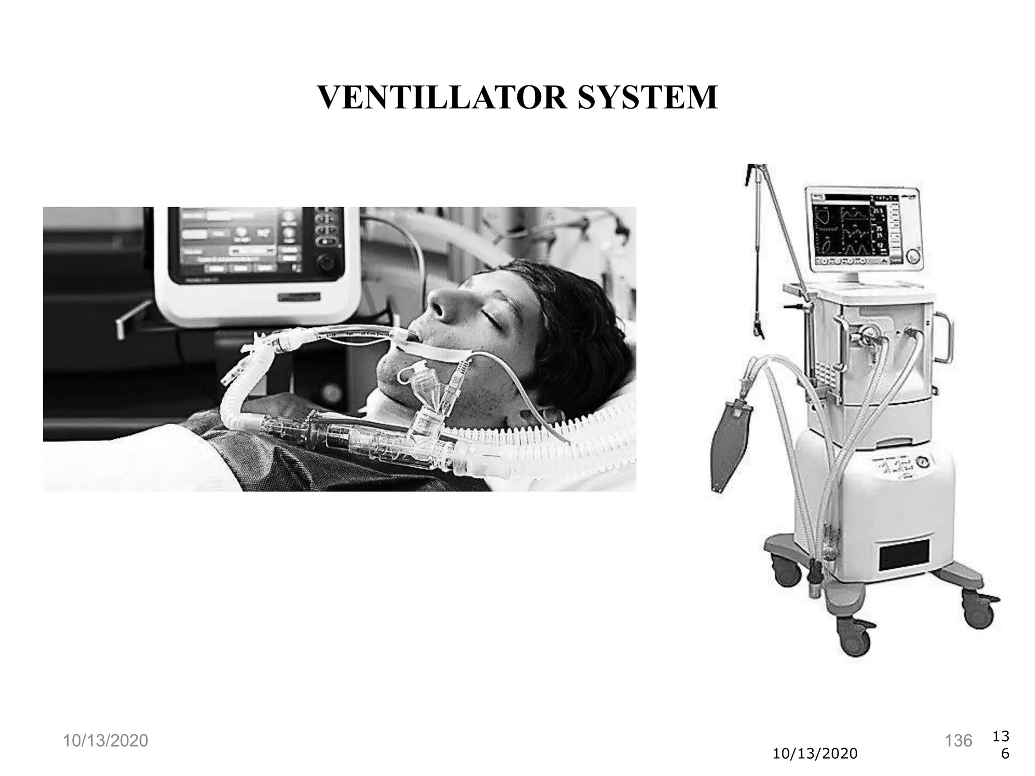 10/13/2020 136
10/13/2020
13
6
VENTILLATOR SYSTEM
 
