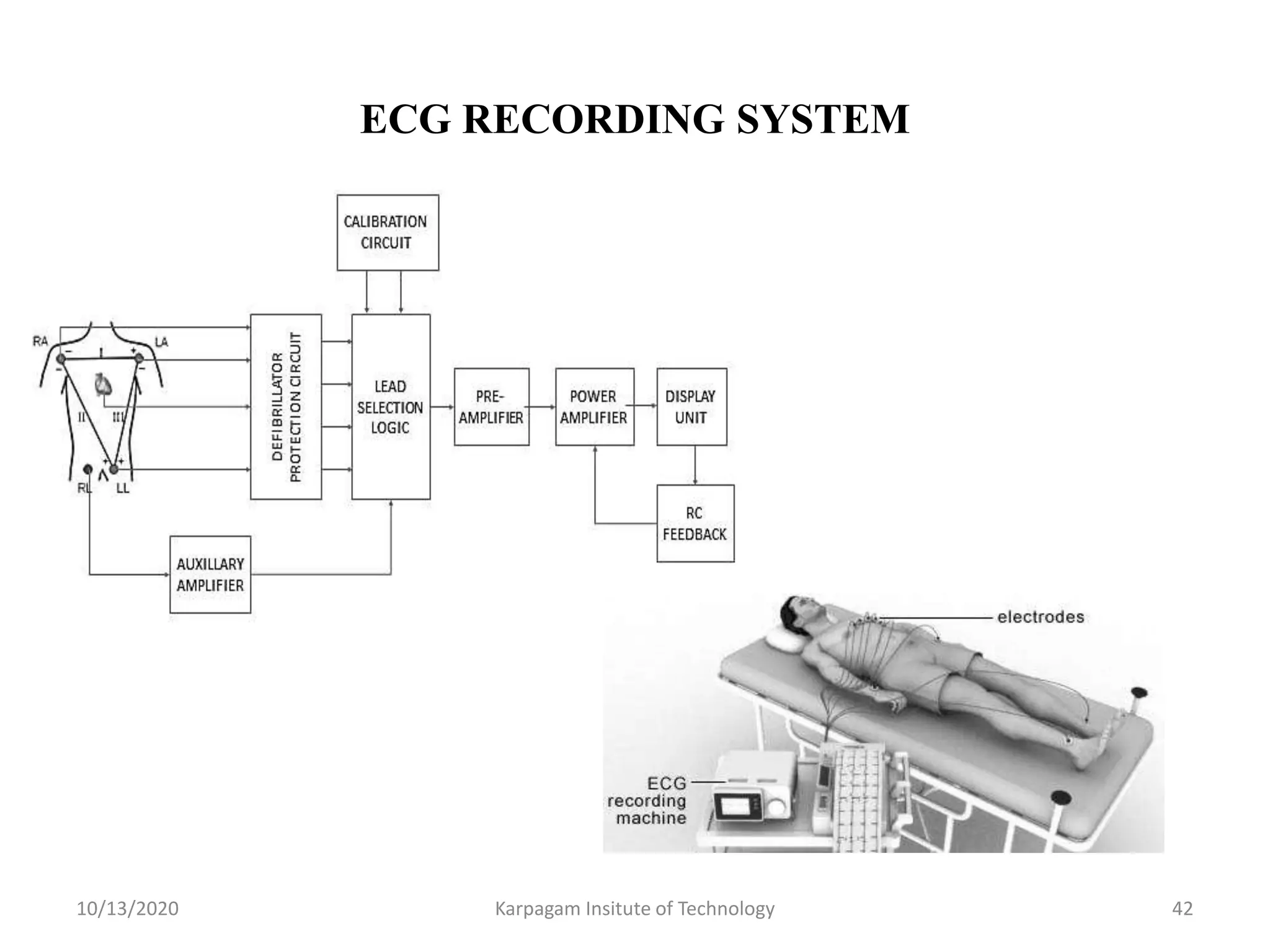 ECG RECORDING SYSTEM
10/13/2020 Karpagam Insitute of Technology 42
 