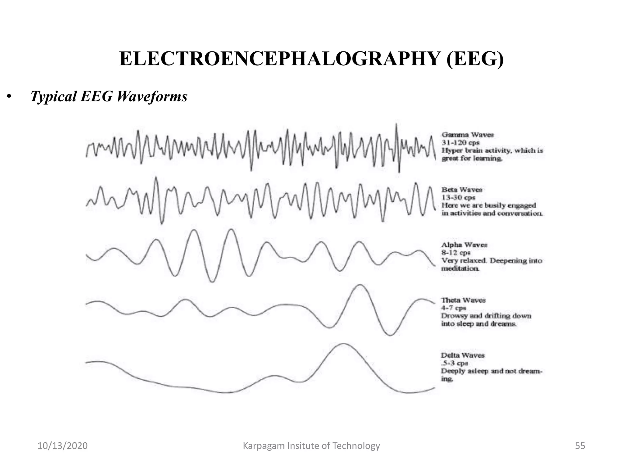 ELECTROENCEPHALOGRAPHY (EEG)
• Typical EEG Waveforms
10/13/2020 Karpagam Insitute of Technology 55
 
