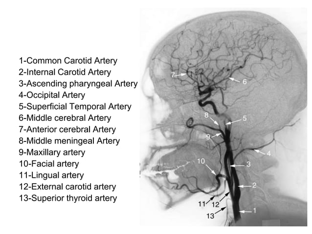 Anatomy of the external carotid artery (ECA) | PPT | Death, Injury, or ...