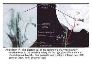 Normal Eca Angiogram Anatomy of the external carotid artery (ECA) | PPT