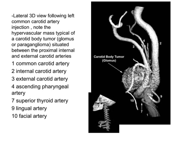 Anatomy of the external carotid artery (ECA) | PPT | Death, Injury, or ...