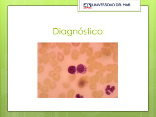 Diagnóstico
 