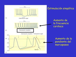 Aumento de la frecuencia cardiaca Aumento de la pendiente del marcapasos Estimulación simpática 