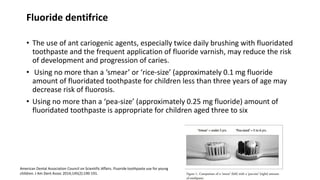 Fluoride dentifrice
• The use of ant cariogenic agents, especially twice daily brushing with fluoridated
toothpaste and the frequent application of fluoride varnish, may reduce the risk
of development and progression of caries.
• Using no more than a ‘smear’ or ‘rice-size’ (approximately 0.1 mg fluoride
amount of fluoridated toothpaste for children less than three years of age may
decrease risk of fluorosis.
• Using no more than a ‘pea-size’ (approximately 0.25 mg fluoride) amount of
fluoridated toothpaste is appropriate for children aged three to six
American Dental Association Council on Scientific Affairs. Fluoride toothpaste use for young
children. J Am Dent Assoc 2014;145(2):190-191.
 