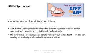 Lift the lip concept
• an assessment tool for childhood dental decay
• “Lift the Lip” concept was developed to provide appropriate oral health
information to parents and child health professionals.
• The information encourages people to “Check your child’s teeth – lift the lip”,
looking for early signs of tooth decay once a month.
Lift the Lip: an assessment tool for childhood dental decay
Mary Wilson – 2017
 