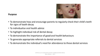 Purpose
• To demonstrate how and encourage parents to regularly check their child’s teeth
for signs of tooth decay
• To individualise oral health advice
• To highlight individual risk of dental decay
• To demonstrate the importance of good oral health behaviours
• To generate appropriate referrals to dental services
• To demonstrate the individual’s need for attendance to those dental services
Lift the Lip: an assessment tool for childhood dental decay
Mary Wilson – 2017
 