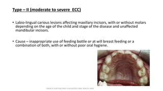 Type – II (moderate to severe ECC)
• Labio-lingual carious lesions affecting maxillary incisors, with or without molars
depending on the age of the child and stage of the disease and unaffected
mandibular incisors.
• Cause – inappropriate use of feeding bottle or at will breast feeding or a
combination of both, with or without poor oral hygiene.
J BERG,R SLAYTON,EARLY CHILDHOOD ORAL HEALTH,2009
 