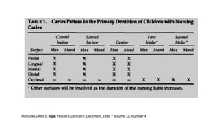 NURSING CARIES: Ripa: Pediatric Dentistry: December, 1988 ~ Volume 10, Number 4
 