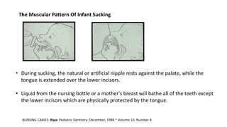 The Muscular Pattern Of Infant Sucking
NURSING CARIES: Ripa: Pediatric Dentistry: December, 1988 ~ Volume 10, Number 4
• During sucking, the natural or artificial nipple rests against the palate, while the
tongue is extended over the lower incisors.
• Liquid from the nursing bottle or a mother's breast will bathe all of the teeth except
the lower incisors which are physically protected by the tongue.
 