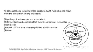 NURSING CARIES: Ripa: Pediatric Dentistry: December, 1988 ~ Volume 10, Number 4
All carious lesions, including those associated with nursing caries, result
from the interaction among 4 variables:
(1) pathogenic microorganisms in the Mouth
(2) fermentable carbohydrates that the microorganisms metabolize to
organic acids
(3) tooth surfaces that are susceptible to acid dissolution
(4) time
 