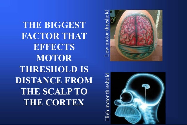 h coil tms September  2016 Summit Brain &  Neuromodulation BH Stimulation h coil tms September  2016 Summit Brain &  Neuromodulation BH Stimulation