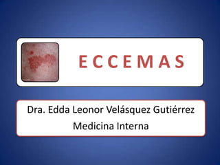 ECCEMAS

Dra. Edda Leonor Velásquez Gutiérrez
          Medicina Interna
 