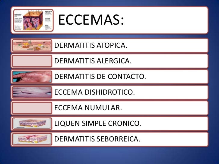 Como ser curado asd de la psoriasis
